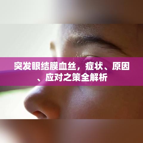 突发眼结膜血丝，症状、原因、应对之策全解析